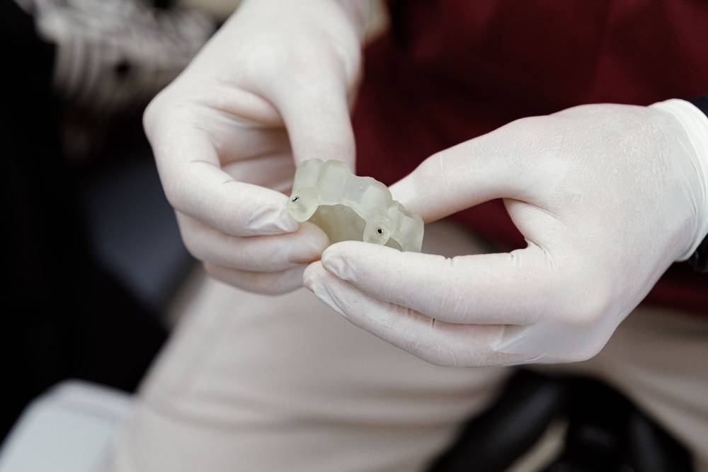 Beskausmės implantacijos galimybės